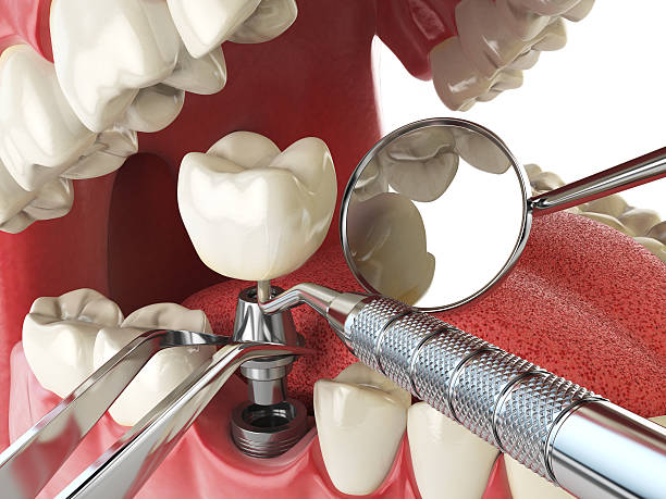 Best Emergency Dental Care for Trauma or Injury in Mount Pleasant, WI