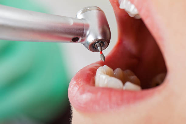 Best Emergency Broken Tooth Repair in Mount Pleasant, WI